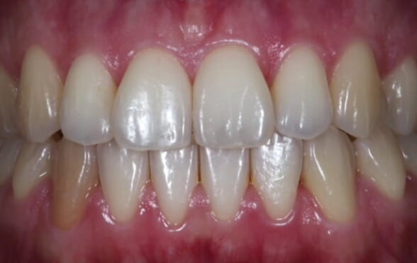 After -Bollington Dental Practice