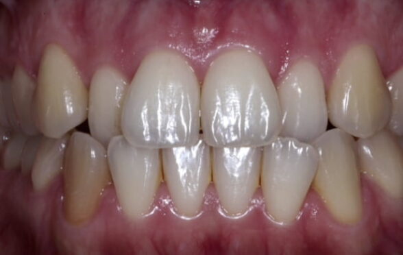 Before - Bollington Dental Practice